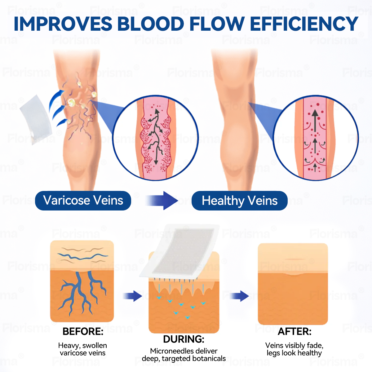Jedan flaster dnevno. Vidljivo olakšanje kod varikoznih vena već za samo 7 dana. 👨‍⚕️ 𝐅𝐋𝐎𝐑𝐈𝐒𝐌𝐀® 𝐝𝐢𝐨𝐬𝐦𝐢𝐧 𝐢 𝐡𝐞𝐬𝐩𝐞𝐫𝐢𝐝𝐢𝐧: 𝐟𝐥𝐚𝐬𝐭𝐞𝐫 𝐬 𝐦𝐢𝐤𝐫𝐨𝐧𝐚𝐝𝐥𝐚𝐧𝐢𝐜𝐚𝐦𝐚 𝐢 𝐟𝐨𝐫𝐦𝐮𝐥𝐨𝐦 𝐤𝐥𝐢𝐧𝐢č𝐤𝐞 𝐤𝐯𝐚𝐥𝐢𝐭𝐞𝐭𝐞🌵