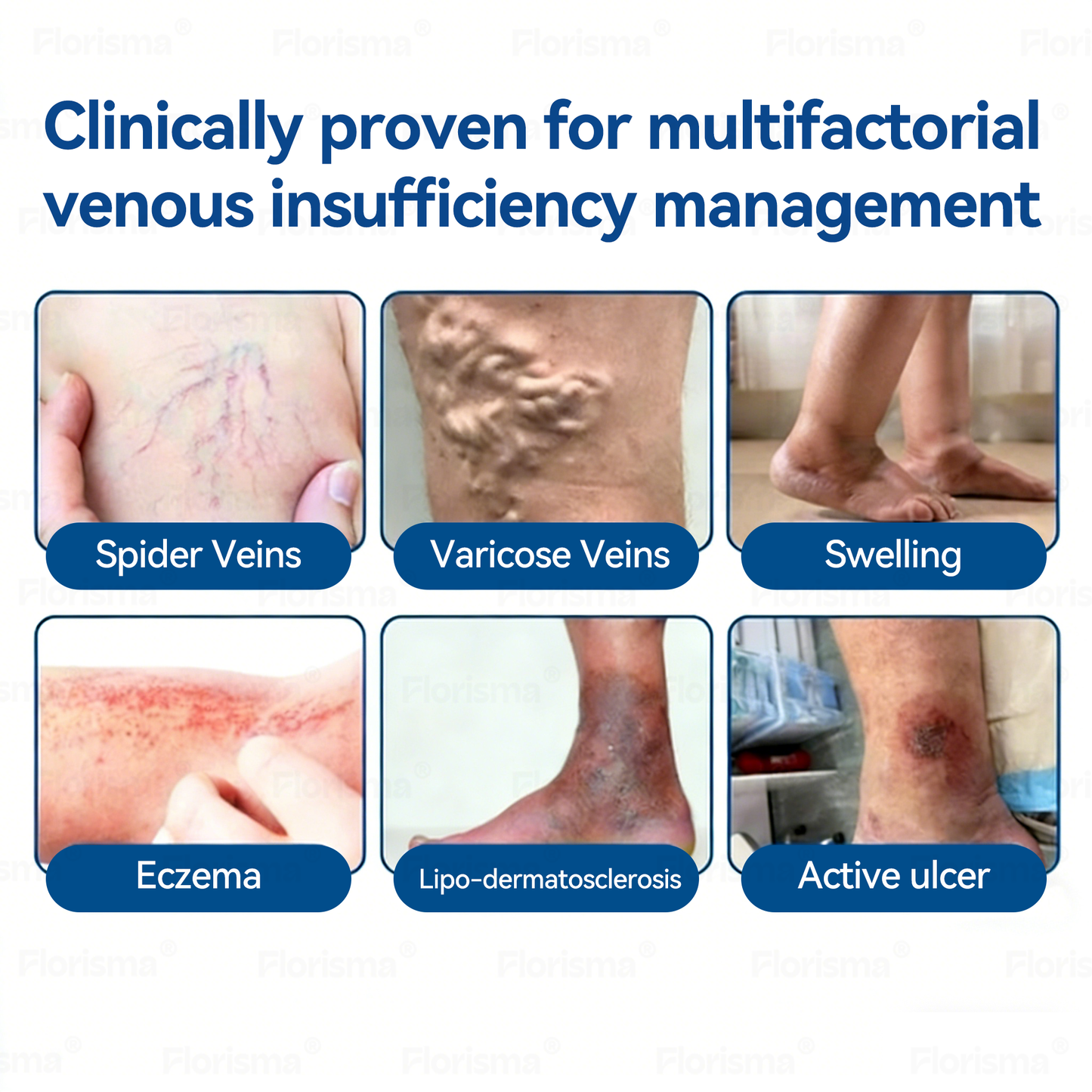 Jedan flaster dnevno. Vidljivo olakšanje kod varikoznih vena već za samo 7 dana. 👨‍⚕️ 𝐅𝐋𝐎𝐑𝐈𝐒𝐌𝐀® 𝐝𝐢𝐨𝐬𝐦𝐢𝐧 𝐢 𝐡𝐞𝐬𝐩𝐞𝐫𝐢𝐝𝐢𝐧: 𝐟𝐥𝐚𝐬𝐭𝐞𝐫 𝐬 𝐦𝐢𝐤𝐫𝐨𝐧𝐚𝐝𝐥𝐚𝐧𝐢𝐜𝐚𝐦𝐚 𝐢 𝐟𝐨𝐫𝐦𝐮𝐥𝐨𝐦 𝐤𝐥𝐢𝐧𝐢č𝐤𝐞 𝐤𝐯𝐚𝐥𝐢𝐭𝐞𝐭𝐞🌵