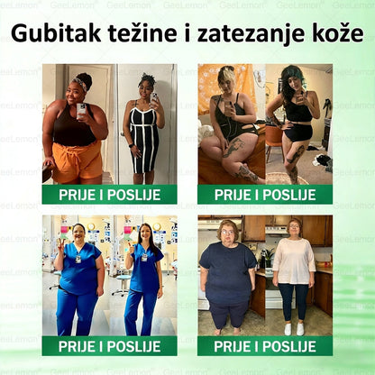 Službena certifikacija🍧 Tisuće zadovoljnih korisnika u Hrvatskoj🔥𝐆𝐞𝑒𝐿𝑒𝐦𝐨𝐧® 𝐆𝐥𝐮𝐦𝐚𝐬𝐞𝐭𝐢𝐝𝐞 8 IN 1" TANAK I ZDRAV MIKROIGLICNI FLASTER S NANOPARTIKLAMA (Samo jednom dnevno, vidljive promjene za 7 dana)  ✅
