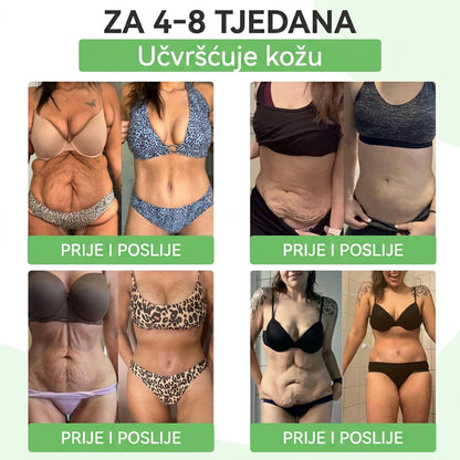 Službena certifikacija🍧 Tisuće zadovoljnih korisnika u Hrvatskoj🔥𝐆𝐞𝑒𝐿𝑒𝐦𝐨𝐧® 𝐆𝐥𝐮𝐦𝐚𝐬𝐞𝐭𝐢𝐝𝐞 8 IN 1" TANAK I ZDRAV MIKROIGLICNI FLASTER S NANOPARTIKLAMA (Samo jednom dnevno, vidljive promjene za 7 dana)  ✅