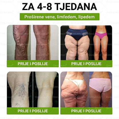 Službena certifikacija🍧 Tisuće zadovoljnih korisnika u Hrvatskoj🔥𝐆𝐞𝑒𝐿𝑒𝐦𝐨𝐧® 𝐆𝐥𝐮𝐦𝐚𝐬𝐞𝐭𝐢𝐝𝐞 8 IN 1" TANAK I ZDRAV MIKROIGLICNI FLASTER S NANOPARTIKLAMA (Samo jednom dnevno, vidljive promjene za 7 dana)  ✅
