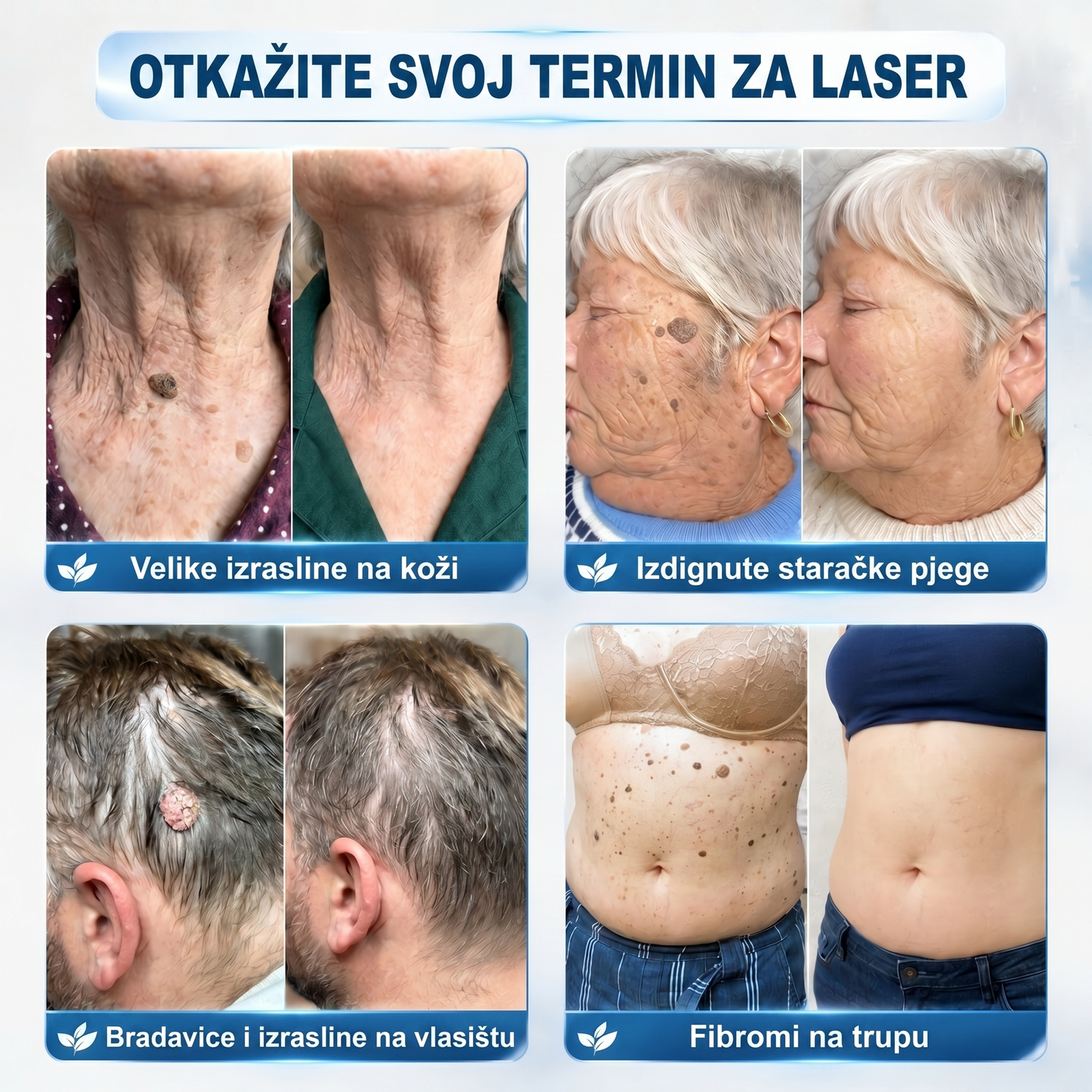 🍁𝐒𝐥𝐮ž𝐛𝐞𝐧𝐚 𝐭𝐫𝐠𝐨𝐯𝐢𝐧𝐚 𝐫𝐨𝐛𝐧𝐞 𝐦𝐚𝐫𝐤𝐞  𝐏𝐢𝐜𝐝𝐨®   𝟕-𝐝𝐧𝐞𝐯𝐧𝐢 𝐨𝐝𝐬𝐭𝐫𝐚𝐧𝐣𝐢𝐯𝐚č 𝐛𝐫𝐚𝐝𝐚𝐯𝐢𝐜𝐚 𝐢 𝐦𝐫𝐥𝐣𝐚(Nula boli, nula 𝐒𝐜𝐚𝒓𝒔 Rollerball)