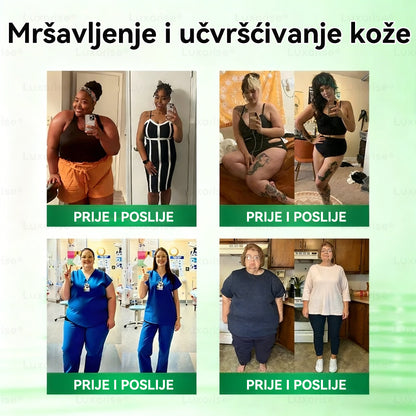 Codziennie raz, widoczne zmiany w ciągu 7 dni 🎠 𝑳𝒖𝒙𝒂𝒓𝒊𝒔𝒆® Moringa & Berberyna 10-w-1 Zaawansowana Nano Mikronakłuwająca Plastry 👩‍⚕️ Otyłość, Cukrzyca, Bezdech Senny i Problemy ze Stawami