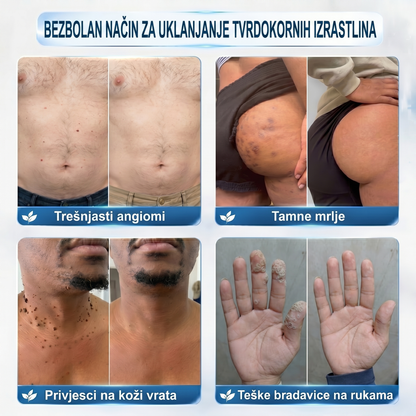 🍁𝐒𝐥𝐮ž𝐛𝐞𝐧𝐚 𝐭𝐫𝐠𝐨𝐯𝐢𝐧𝐚 𝐫𝐨𝐛𝐧𝐞 𝐦𝐚𝐫𝐤𝐞  𝐏𝐢𝐜𝐝𝐨®   𝟕-𝐝𝐧𝐞𝐯𝐧𝐢 𝐨𝐝𝐬𝐭𝐫𝐚𝐧𝐣𝐢𝐯𝐚č 𝐛𝐫𝐚𝐝𝐚𝐯𝐢𝐜𝐚 𝐢 𝐦𝐫𝐥𝐣𝐚(Nula boli, nula 𝐒𝐜𝐚𝒓𝒔 Rollerball)