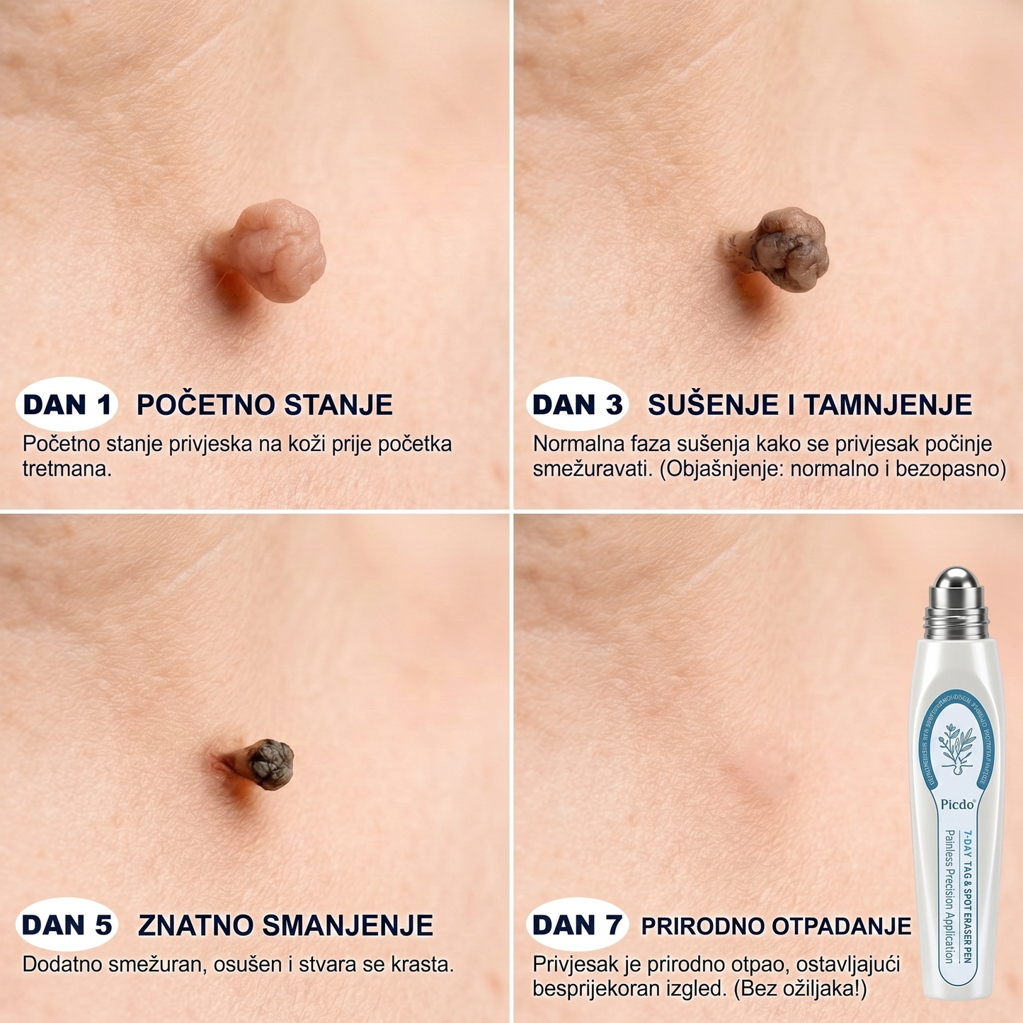 🍁𝐒𝐥𝐮ž𝐛𝐞𝐧𝐚 𝐭𝐫𝐠𝐨𝐯𝐢𝐧𝐚 𝐫𝐨𝐛𝐧𝐞 𝐦𝐚𝐫𝐤𝐞  𝐏𝐢𝐜𝐝𝐨®   𝟕-𝐝𝐧𝐞𝐯𝐧𝐢 𝐨𝐝𝐬𝐭𝐫𝐚𝐧𝐣𝐢𝐯𝐚č 𝐛𝐫𝐚𝐝𝐚𝐯𝐢𝐜𝐚 𝐢 𝐦𝐫𝐥𝐣𝐚(Nula boli, nula 𝐒𝐜𝐚𝒓𝒔 Rollerball)