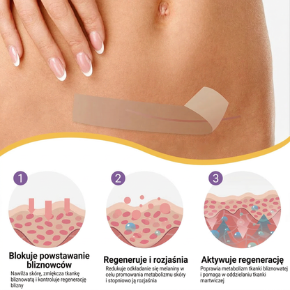 ✅Oficjalny sklep | BBOJI® kwas hialuronowy nano-mikroigłowa taśma naprawcza 🏥(leczenie starych i nowych blizn, redukcja blizn pooperacyjnych, rozstępów, bliznowców, trądziku, oparzeń, brodawek, zmian skórnych oraz żylaków)