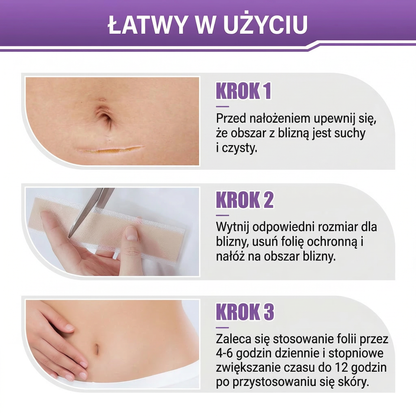 ✅Oficjalny sklep | BBOJI® kwas hialuronowy nano-mikroigłowa taśma naprawcza 🏥(leczenie starych i nowych blizn, redukcja blizn pooperacyjnych, rozstępów, bliznowców, trądziku, oparzeń, brodawek, zmian skórnych oraz żylaków)